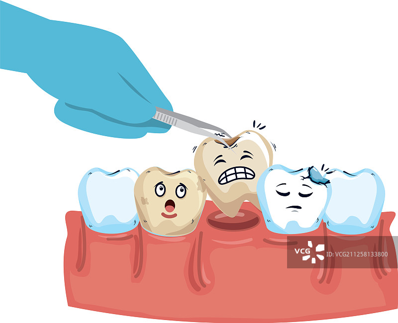 牙医用钳子拔牙图片素材