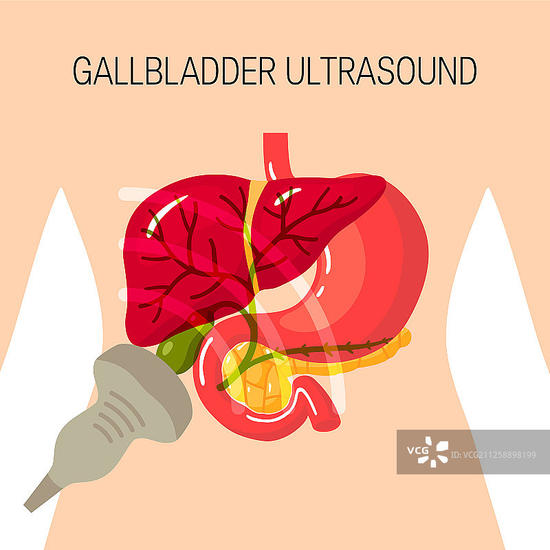 胆囊超声波概念图片素材