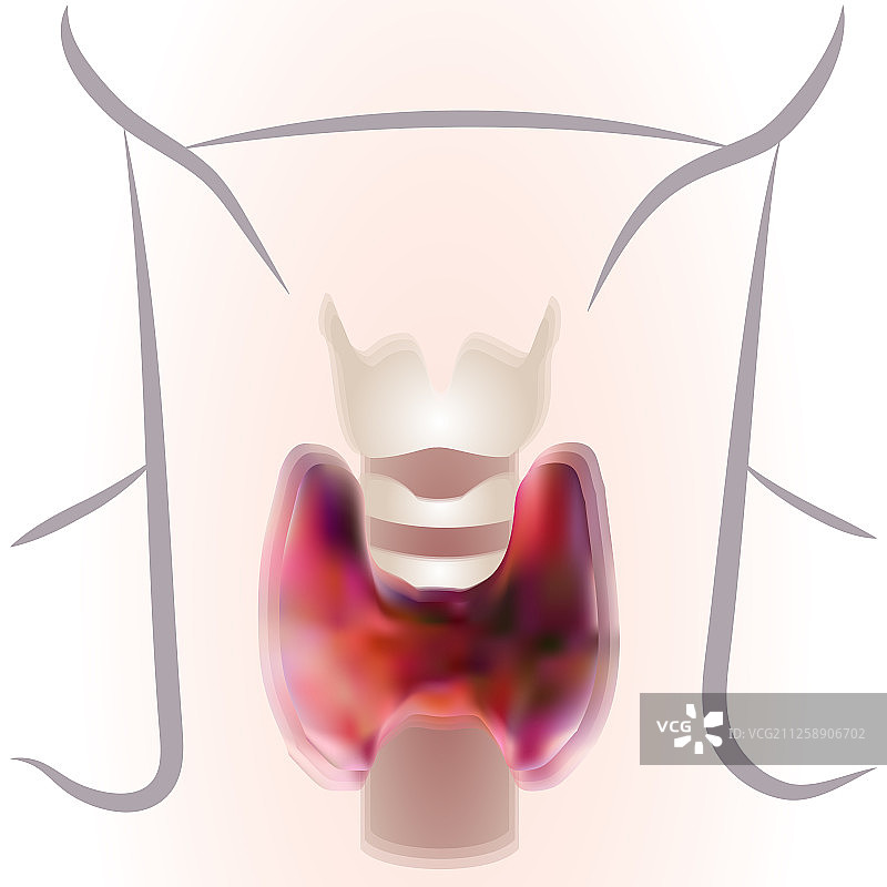 甲状腺结构图图片素材