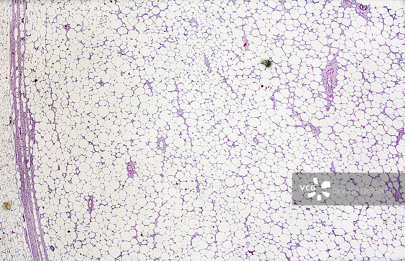 生物病理显微镜切片脂肪瘤标本白底显微摄影教学素材图片素材