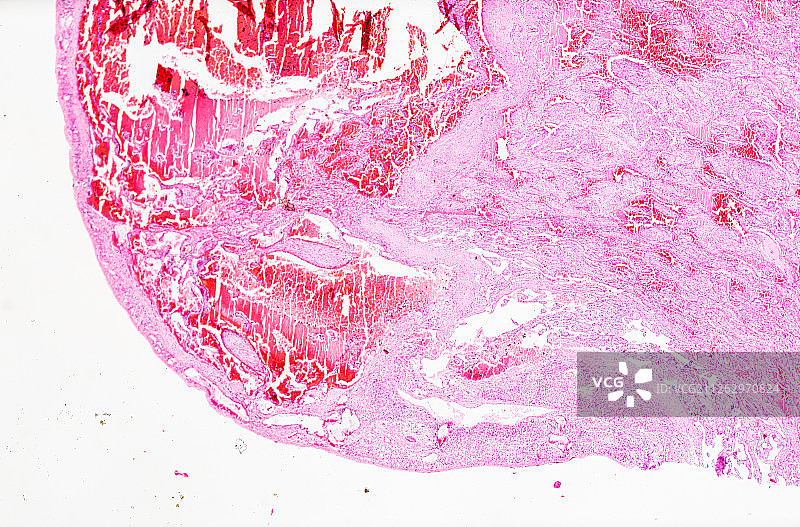 生物病理显微镜切片血管瘤标本白底显微摄影教学素材图片素材