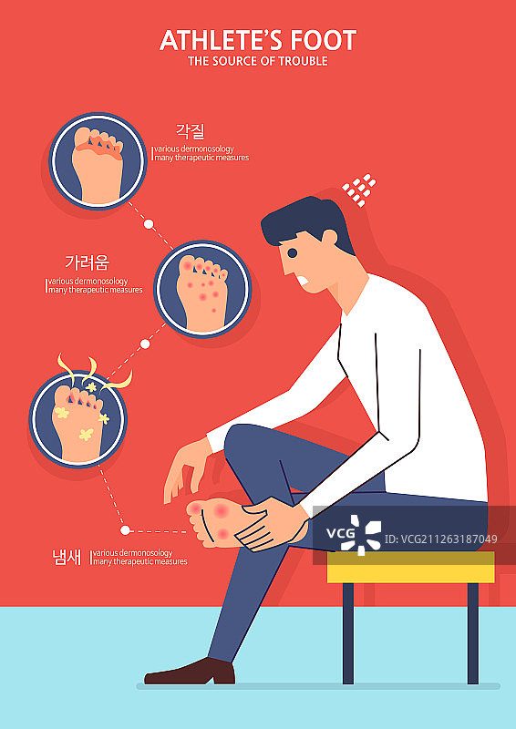 插画，过敏，疾病，医院，诊所，病毒，脚气，湿疹图片素材