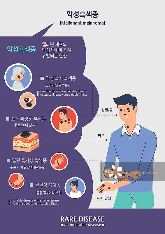身体疾病、人体器官、黑色素瘤、皮肤癌（男性）图片素材