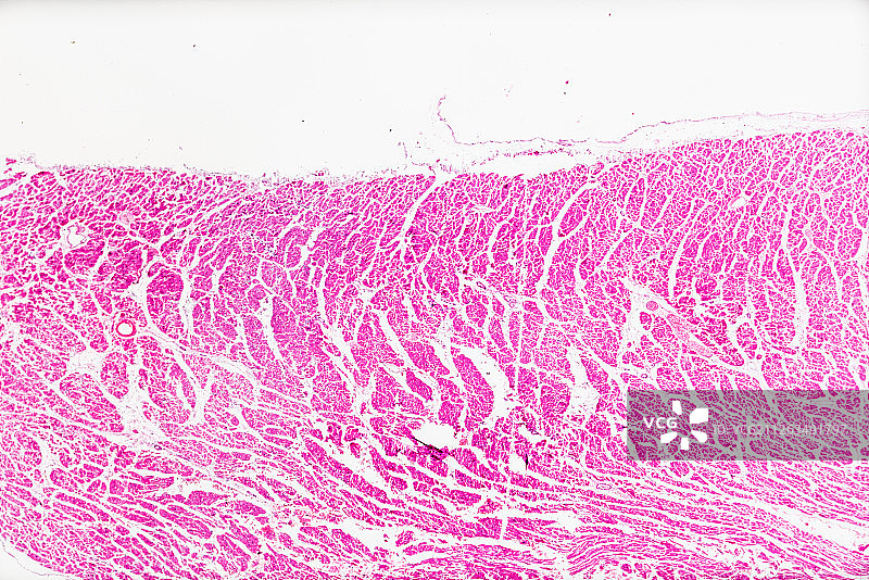 生物病理显微镜切片风湿性心内膜炎标本白底显微摄影教学素材图片素材