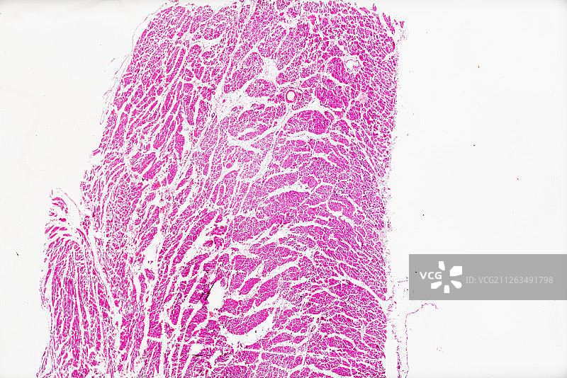 生物病理显微镜切片风湿性心内膜炎标本白底显微摄影教学素材图片素材