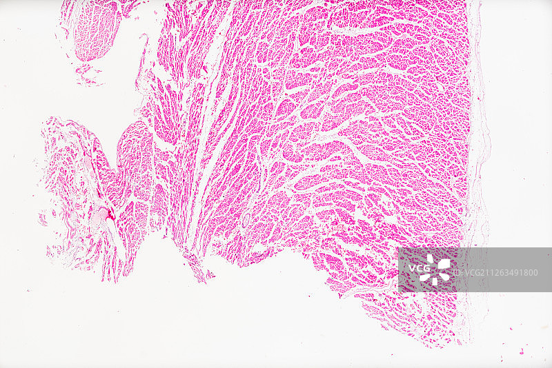 生物病理显微镜切片风湿性心内膜炎标本白底显微摄影教学素材图片素材