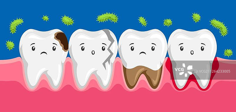 口腔内患病牙齿的插图。儿童牙科悲伤的角色。卡哇伊面部表情。口腔内患病牙齿的插图。图片素材