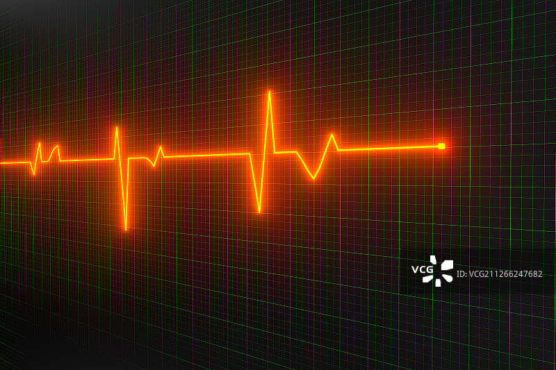 绿色屏幕上的心脏图曲线 三维渲染图片素材