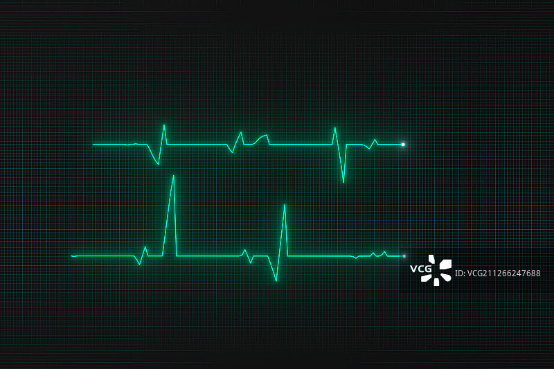绿色屏幕上的心脏图曲线 三维渲染图片素材