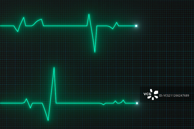 绿色屏幕上的心脏图曲线 三维渲染图片素材