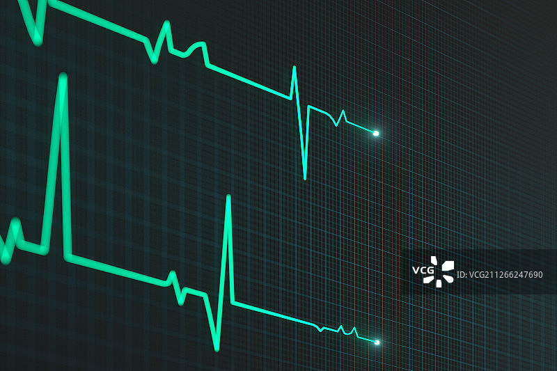 绿色屏幕上的心脏图曲线 三维渲染图片素材