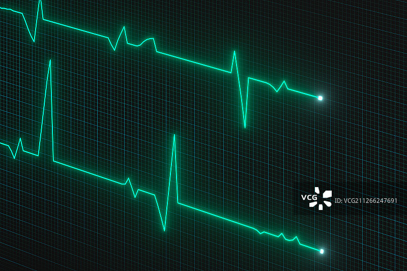 绿色屏幕上的心脏图曲线 三维渲染图片素材