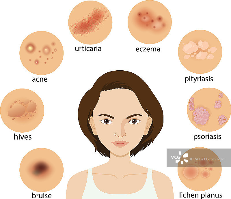 显示不同皮肤状况的图表图片素材
