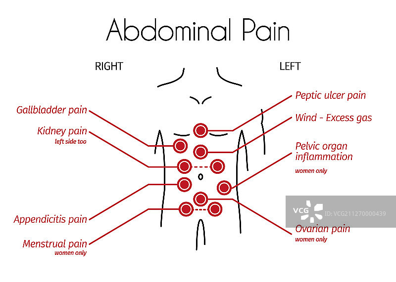 腹痛类型信息图图片素材