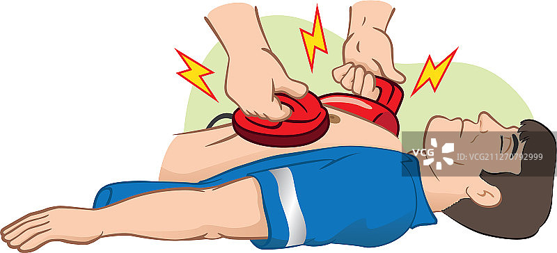 使用除颤器进行急救复苏CPR图片素材