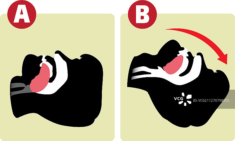 CPR与呼吸道管理图片素材