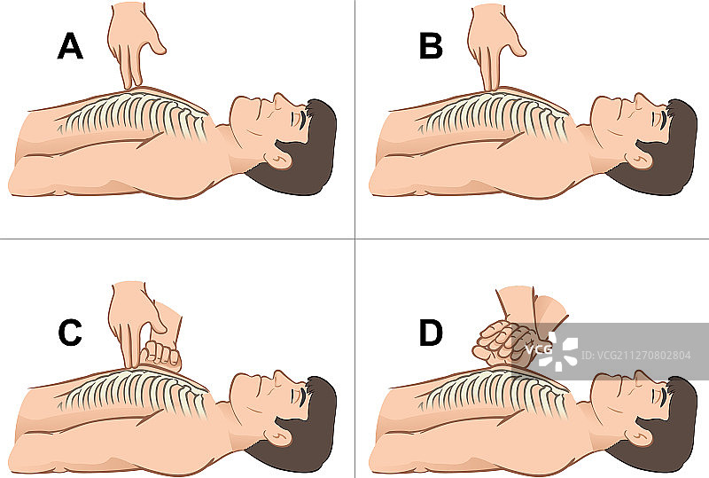 心肺复苏按摩图片素材