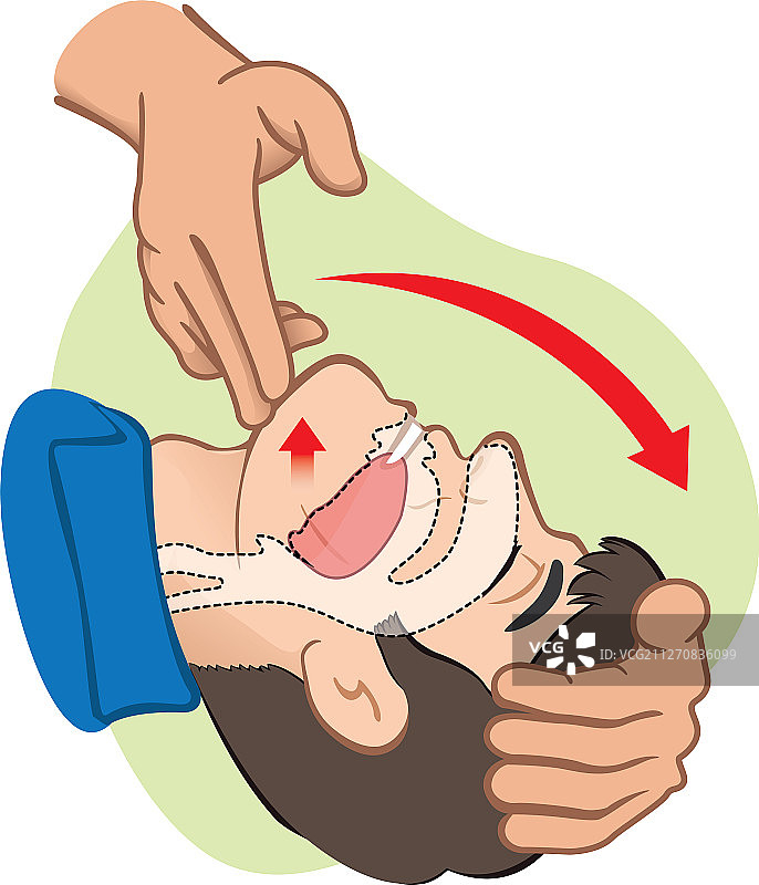 急救人员张嘴清理呼吸道图片素材