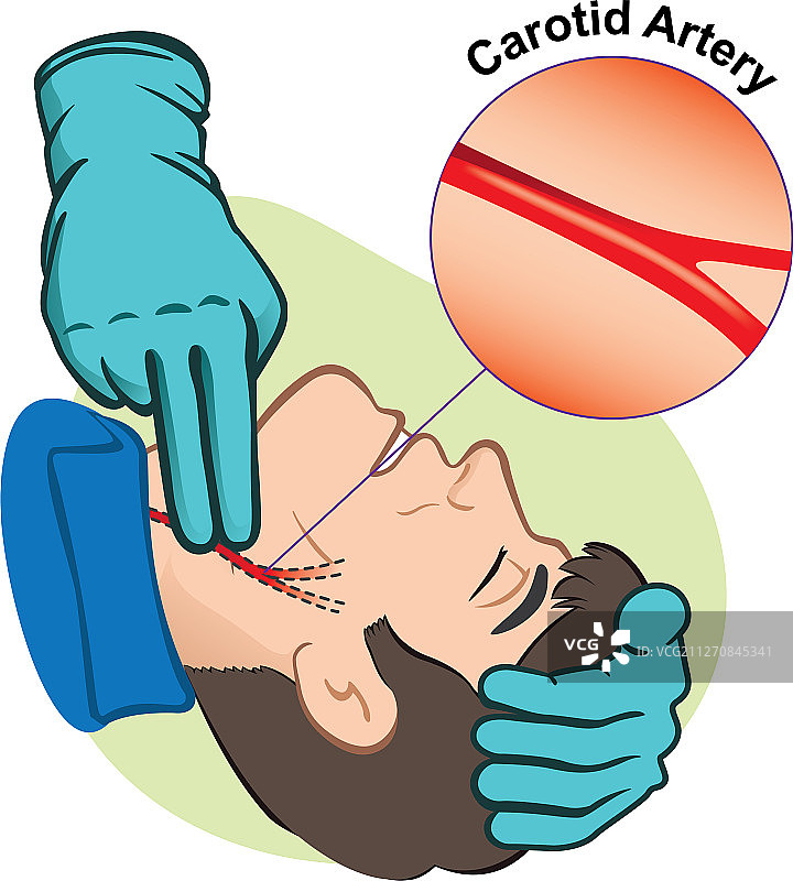 戴着手套的颈动脉脉搏图片素材