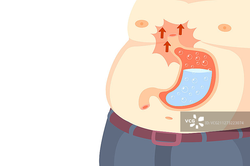 导致胃炎的若干原因图片素材