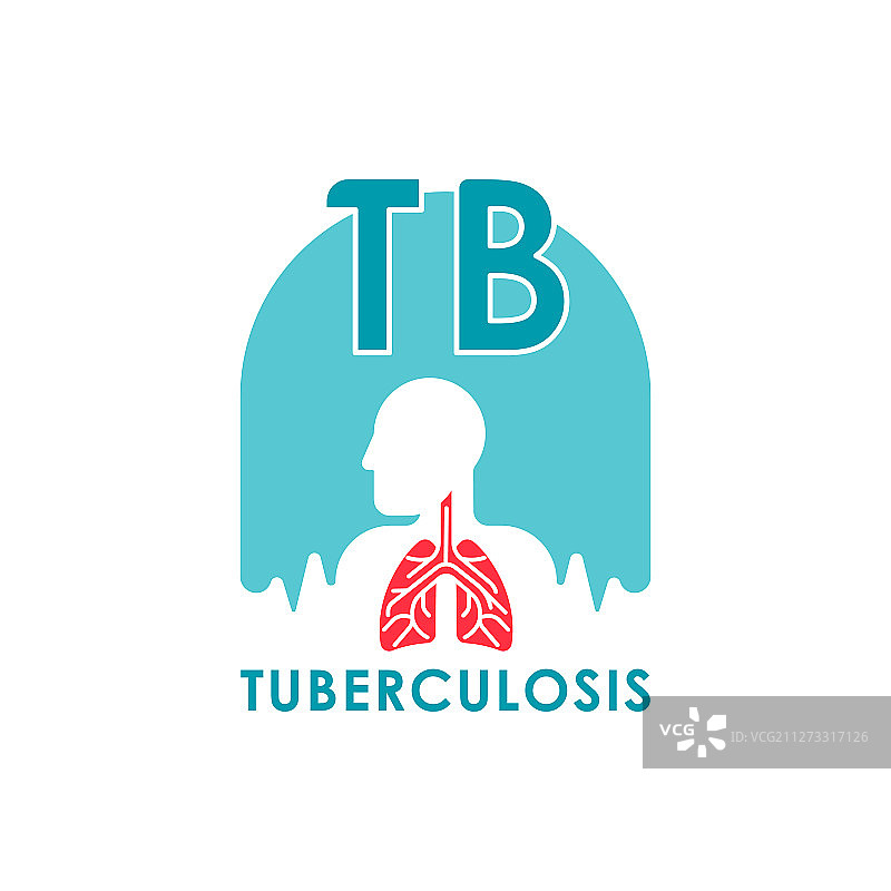 肺结核医学图片素材