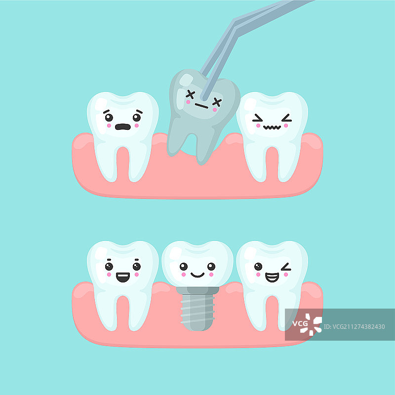 拔牙和种植牙口腔医学图片素材
