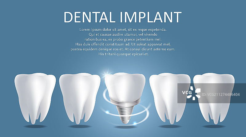 牙科植入体医疗海报banner图片素材