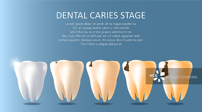 龋齿阶段医学海报banner图片素材