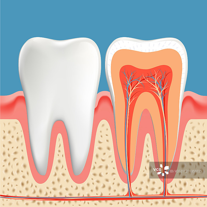 人类牙齿横截面龋齿图图片素材