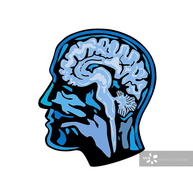 大脑扫描神经影像复古风插画图片素材