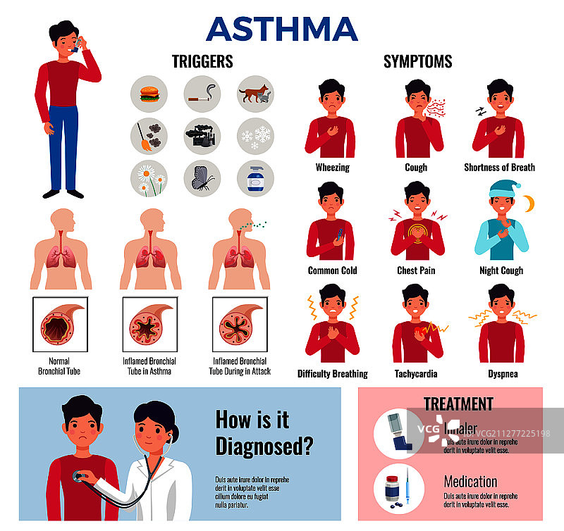 哮喘慢性疾病扁平化信息图元素合集，包含诱因、症状、病因、诊断、药物和治疗矢量图图片素材
