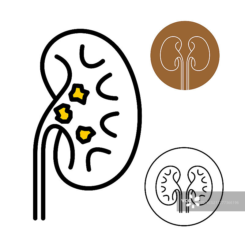 含石头的肾形豆图标图片素材