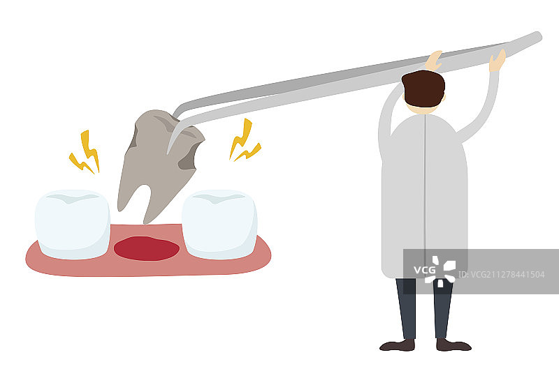 牙科医生拿着镊子正在拔牙图片素材