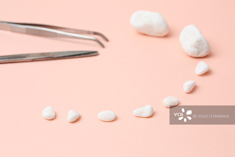 胆石症图片素材