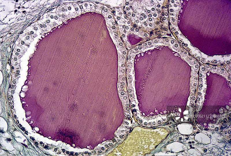 大鼠甲状腺滤泡图片素材