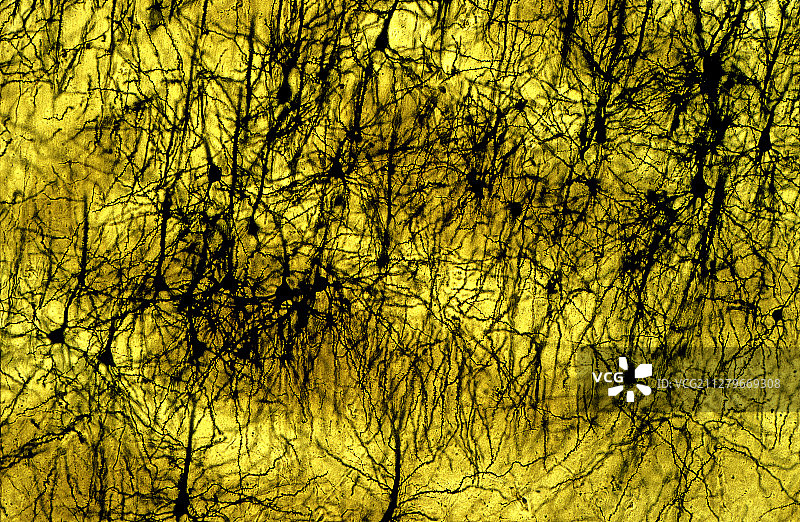 人脑皮层图片素材