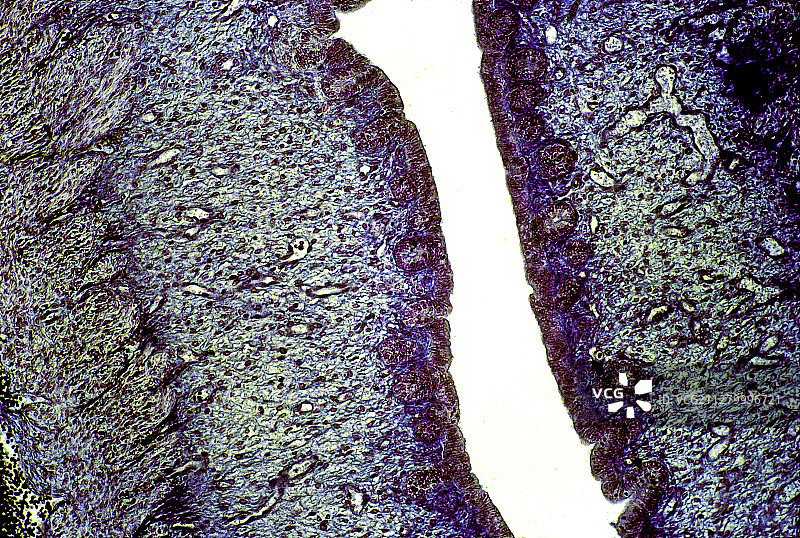 兔子子宫（Oryctolagus cuniculus）- 卵泡期图片素材