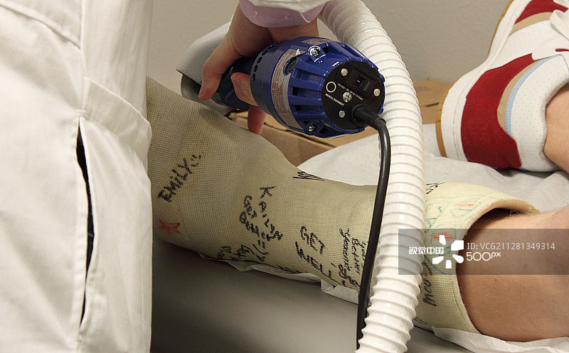 医生为青少年男孩拆除腿部石膏图片素材