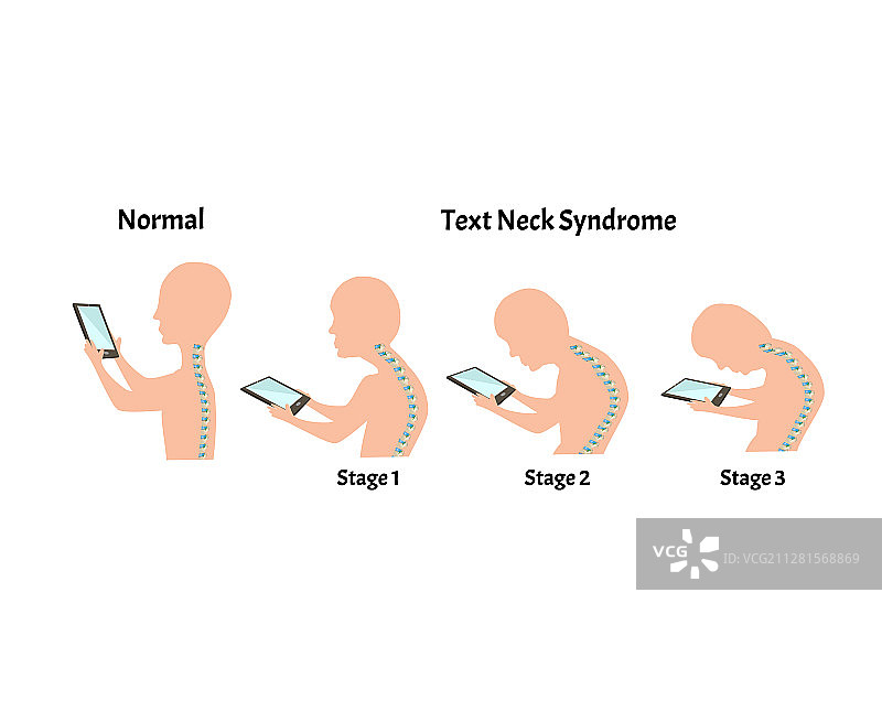 不良姿势症状阶段文本颈图片素材