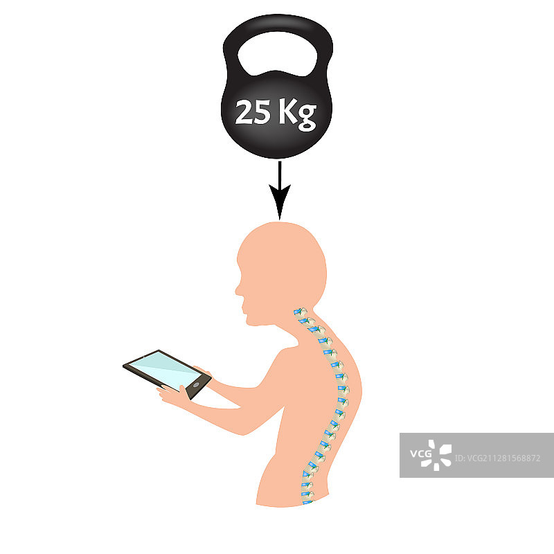 不良姿势症状与颈部综合症图片素材