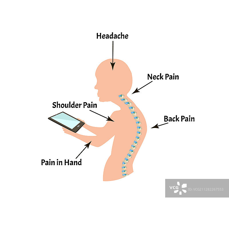不良姿势症状与颈部综合症图片素材