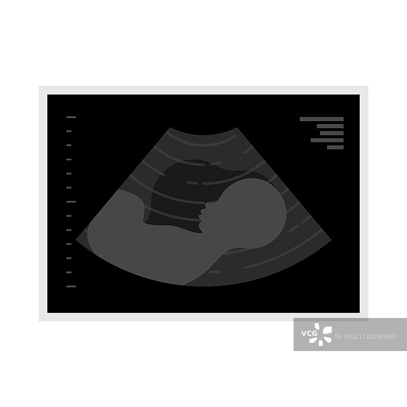 超声波图片扁平图标图片素材