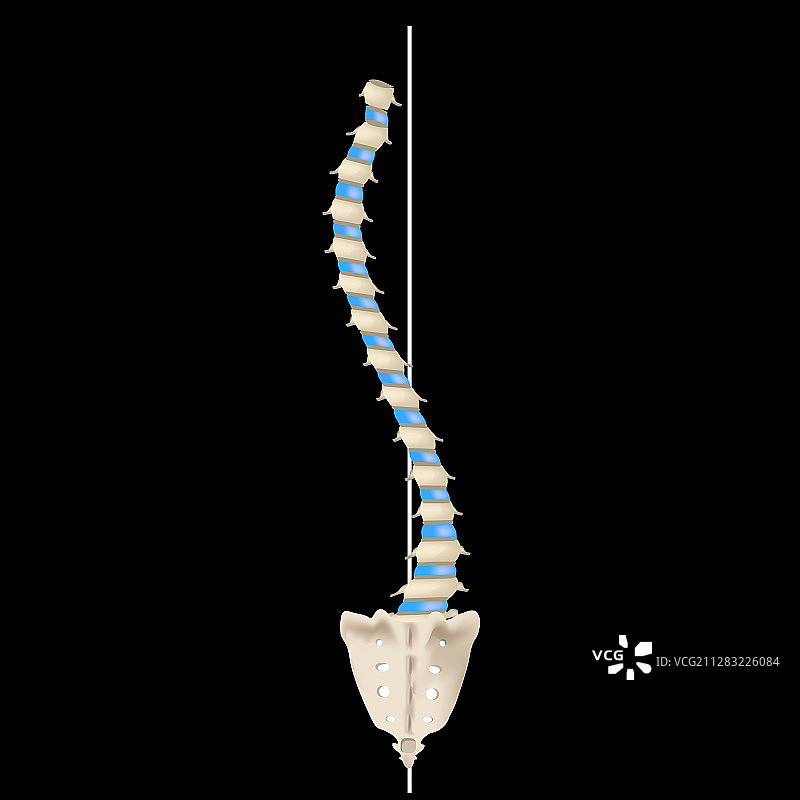 S形脊柱侧弯图片素材
