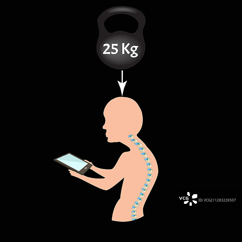 不良姿势症状与颈部综合症图片素材