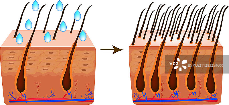 治疗脱发维生素生物素图片素材