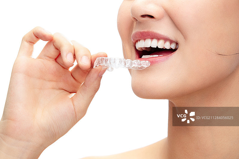准备戴牙套的青年女人嘴部特写图片素材