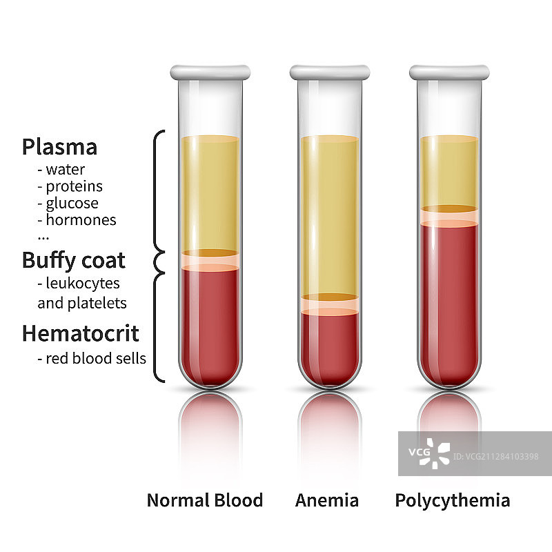血液分析信息图图片素材