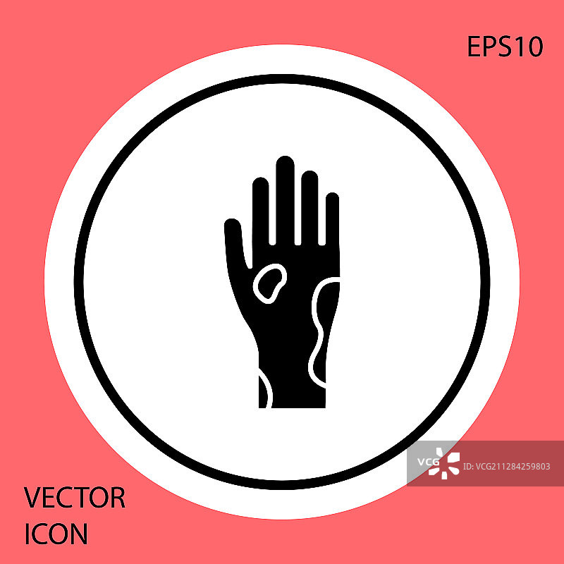 患有牛皮癣或湿疹的手部图标图片素材