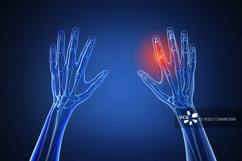 以疼痛突出显示的人体3D渲染图片素材