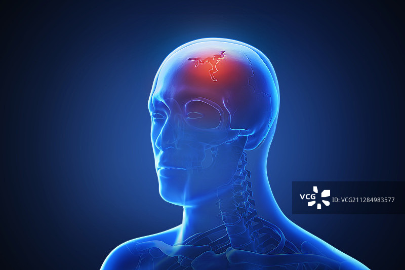 突出显示疼痛的人体3D渲染图片素材